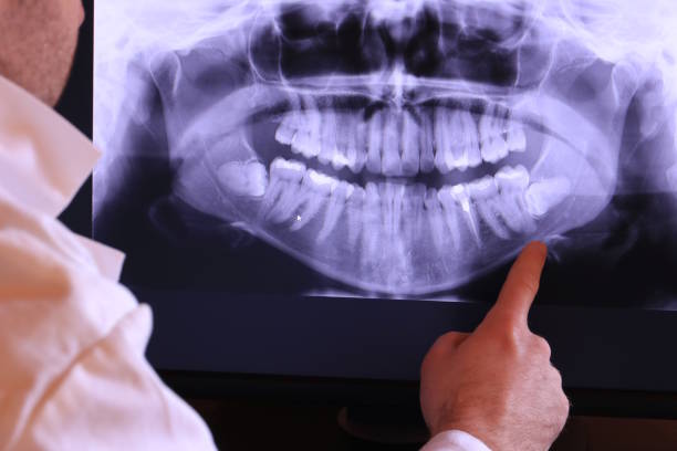 Best Emergency Dental Care for Sports Injuries in Jackson, TN